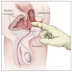 Badanie per rectum (leak)