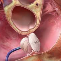 eating bugs is only compatible with a rotten brain