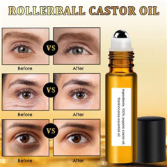 Best Eye Treatment For Dark Circles And Puffy Eyes Reviews