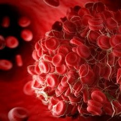 Sid the Songwriter - Blood Clots
