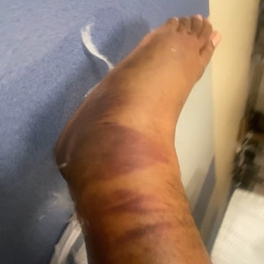 Damn you make that shit look easy! (Easy) prd • manytails11