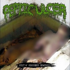 Peptic Ulcer - (Split w Seborrheic Keratosis)(Remastered)