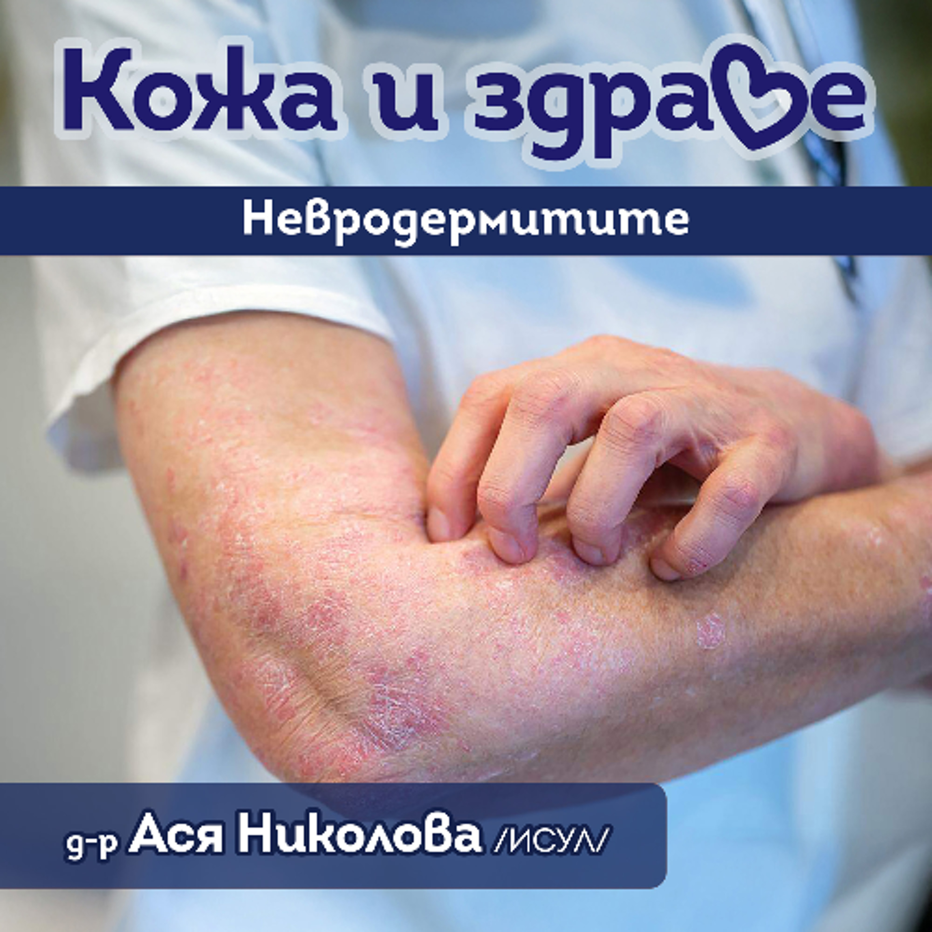 Кожа и здраве - Невродермит episode artwork