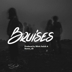 Bruises - Lewis Capaldi (Bläck Snäck & Ikarus_Ofc Technobootleg)