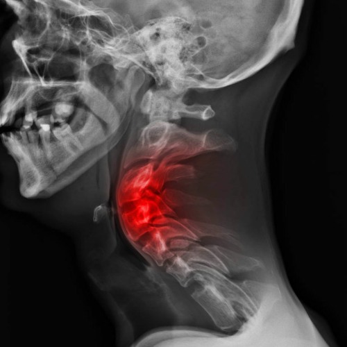 Who Even Needs A Vertebrae (Throw it Down!)EP. I