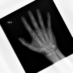 PUSSYKILLER - Папа (Remix BOTG)