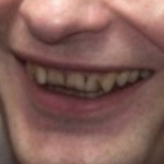 Nedory Satori (Silkskin) - Žiju (Psí Vojáci cover)