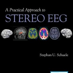 READ PDF EBOOK EPUB KINDLE A Practical Approach to Stereo EEG by  Stephan Schuele MD  MPH 💏