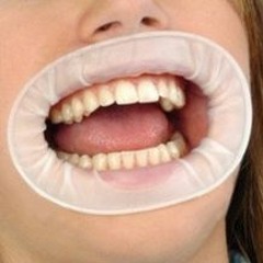 Bouche Qui Parle - Phonotopy Remix