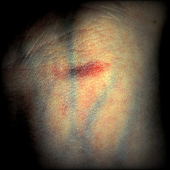 Right Before Anxiety