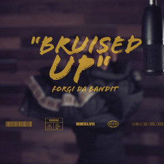 Bruised Up (Lil Durk Remix)