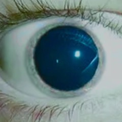 LSD ⁽ᵈᵉᵐᵒ⁾