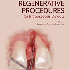 download EBOOK 📁 Simplified Regenerative Procedures for Intraosseous Defects by  Leo
