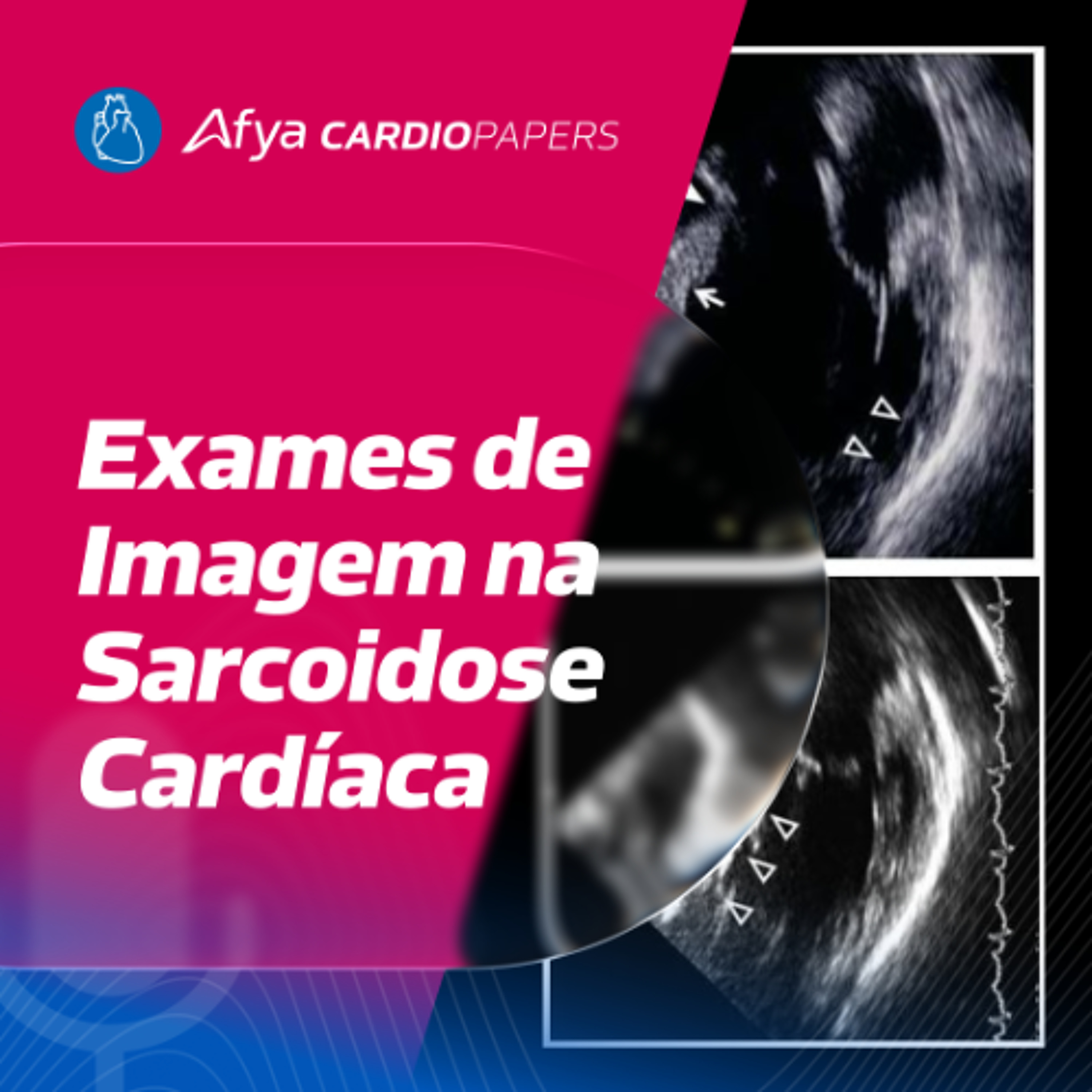 Quais exames solicitar na investigação da sarcoidose cardíaca?
