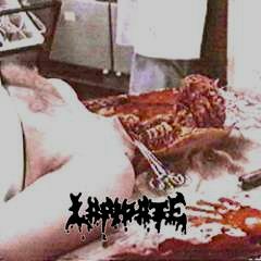 Lapidate - Demo - Anal Spew Stew