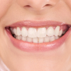 A Guide to 7 Steps for Longevity of Teeth Whitening in San Francisco