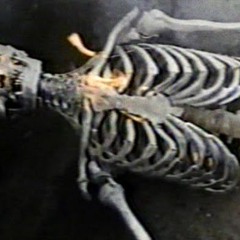 Dryveins - OCD