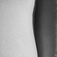 Disquiet