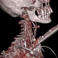 MORE ft.Glory99kid(DiegoSoulja)