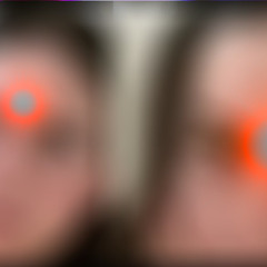 UVA