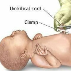 Cut The Umbilical Cord Beat