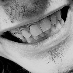 GINGIVITIS