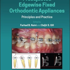 download PDF 📜 Preadjusted Edgewise Fixed Orthodontic Appliances: Principles and Pra