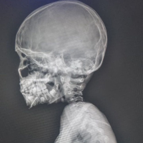 STEVE LACY - I WISH I KNEW (SKHND REMIX SLOWED)