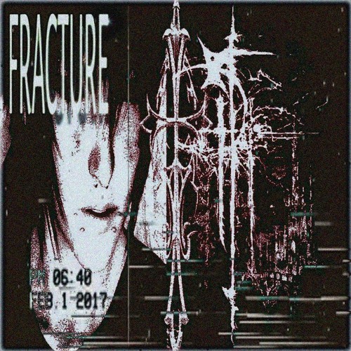 fracture.