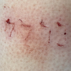 Happiness VII (A Companion to Rhizome Mind Map // Born Version // נוֹלָד