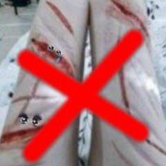 𝄞осколки в запястЪях...