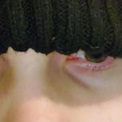 in his eye