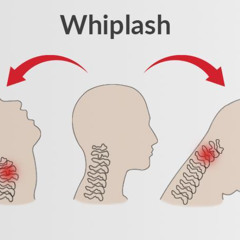 Whiplash