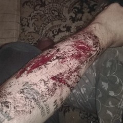 Больно