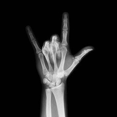 FUNKOT EL PERDON (NICKY JAM )LIVE AT IBIZA SURABAYA DJ ALMIRA BERTO