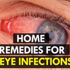 Best Bacterial Eye Infection Treatment Reviews