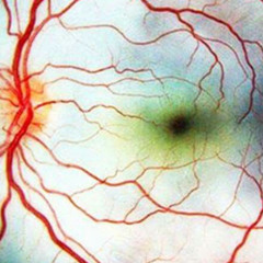 BLINDSPOT (balenciagi)