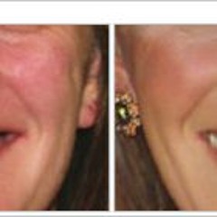 Dentures - 09:08:2023, 14.20