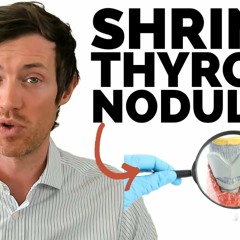 Shrink Thyroid Nodules With These 6 Treatments