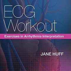 PDF/READ ECG Workout: Exercises in Arrhythmia Interpretation