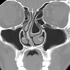 Resistance Is Fertile