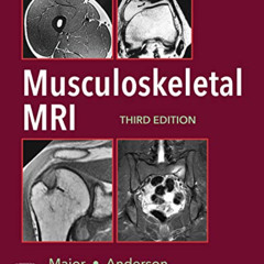 [VIEW] EPUB 📘 Musculoskeletal MRI E-Book by  Nancy M. Major &  Mark W. Anderson [EPU