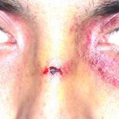 las heridas me las hice yo