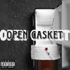 Open Casket
