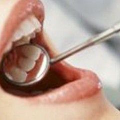 The Dentist Freestyle