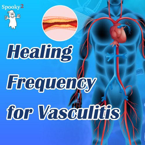 Healing Frequency for  vasculitis - Spooky2 Rife Frequencies