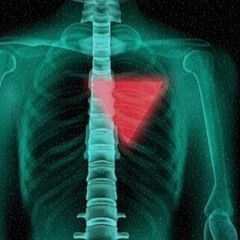 Pierres ou pavés, vitalité de tout cramer en vérité