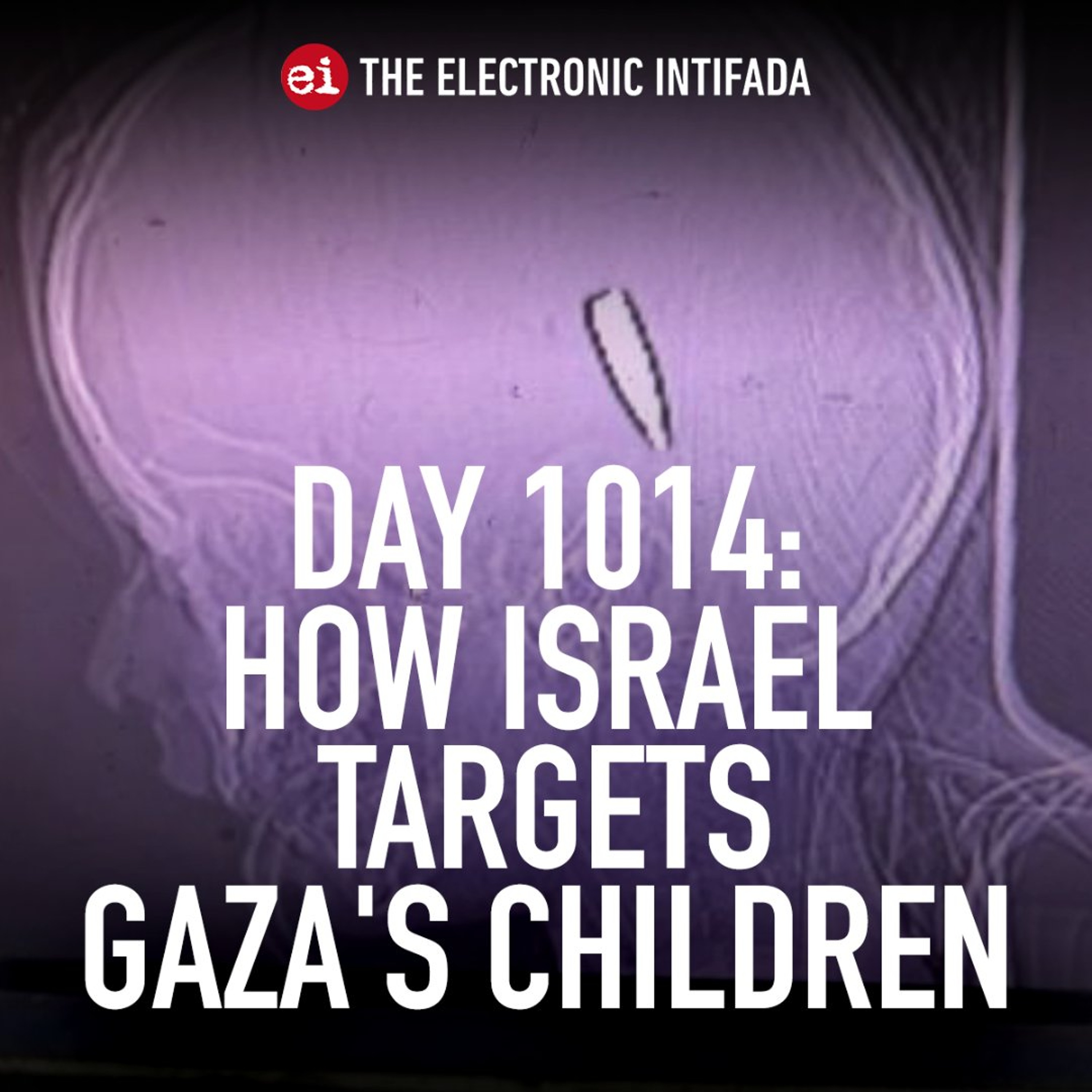 Day 1014: How Israel targets Gaza's children episode artwork