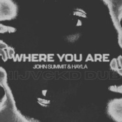 [FREE DL] WHERE YOU ARE (HIJVCKD DUB)