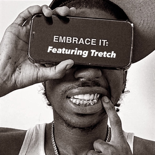 Ndotz - Embrace it (Remix Ft Tretch)